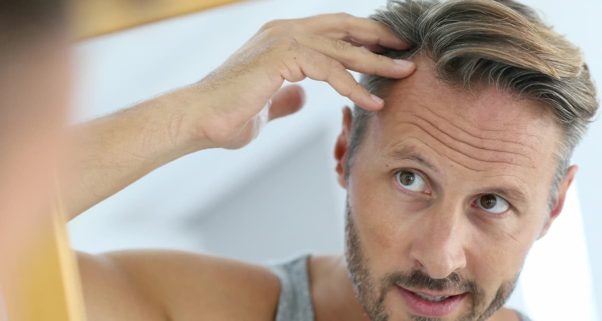 5 mythes sur la perte de cheveux