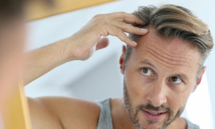5 mythes sur la perte de cheveux